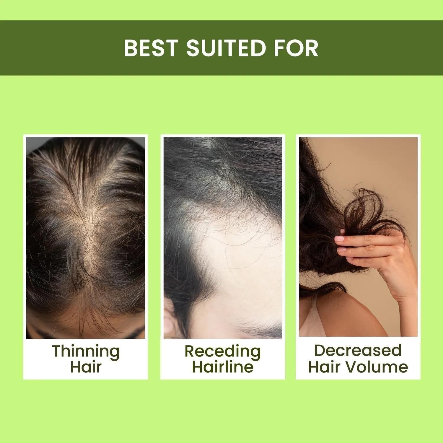 Rosemary Water Hair Spray For Regrowth Buy 1 Get 2 Free